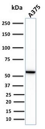 Vimentin (Mesenchymal Cell Marker) Antibody in Western Blot (WB)