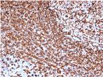 Vimentin Antibody in Immunohistochemistry (Paraffin) (IHC (P))