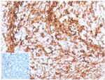 Vimentin Antibody in Immunohistochemistry (Paraffin) (IHC (P))