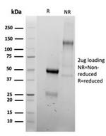 Vimentin Antibody in SDS-PAGE (SDS-PAGE)