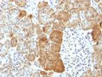 VLDL-Receptor (Very Low Density Lipoprotein Receptor) Antibody in Immunohistochemistry (Paraffin) (IHC (P))