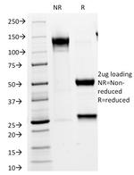 VLDL-Receptor (Very Low Density Lipoprotein Receptor) Antibody in SDS-PAGE (SDS-PAGE)