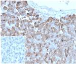 VLDL-Receptor (Very Low Density Lipoprotein Receptor) Antibody in Immunohistochemistry (Paraffin) (IHC (P))