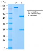 VLDL-Receptor (Very Low Density Lipoprotein Receptor) Antibody in Immunoelectrophoresis (IE)