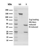 von Willebrand Factor/Factor VIII Related-Ag (Endothelial Marker) Antibody in SDS-PAGE (SDS-PAGE)