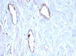 von Willebrand Factor/Factor VIII Related-Ag (Endothelial Marker) Antibody in Immunohistochemistry (Paraffin) (IHC (P))