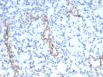 von Willebrand Factor/Factor VIII Related-Ag (Endothelial Marker) Antibody in Immunohistochemistry (Paraffin) (IHC (P))