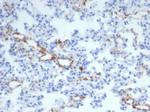 von Willebrand Factor/Factor VIII Related-Ag (Endothelial Marker) Antibody in Immunohistochemistry (Paraffin) (IHC (P))