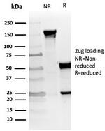 von Willebrand Factor/Factor VIII Related-Ag (Endothelial Marker) Antibody in SDS-PAGE (SDS-PAGE)