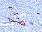 von Willebrand Factor/Factor VIII Related-Ag (Endothelial Marker) Antibody in Immunohistochemistry (Paraffin) (IHC (P))