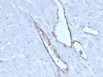 von Willebrand Factor/Factor VIII Related-Ag (Endothelial Marker) Antibody in Immunohistochemistry (Paraffin) (IHC (P))