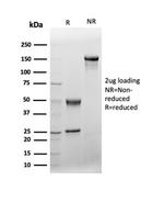 von Willebrand Factor/Factor VIII Related-Ag (Endothelial Marker) Antibody in SDS-PAGE (SDS-PAGE)