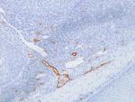 von Willebrand Factor/Factor VIII Related-Ag (Endothelial Marker) Antibody in Immunohistochemistry (Paraffin) (IHC (P))