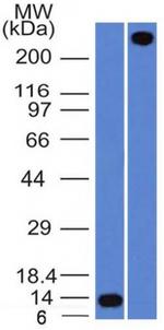 von Willebrand Factor/Factor VIII Related-Ag Antibody in Western Blot (WB)