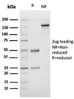 von Willebrand Factor/Factor VIII Related-Ag (Endothelial Marker) Antibody in SDS-PAGE (SDS-PAGE)