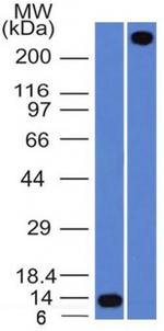 von Willebrand Factor/Factor VIII Related-Ag (Endothelial Marker) Antibody in Western Blot (WB)