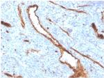 von Willebrand Factor/Factor VIII Related-Ag (Endothelial Marker) Antibody in Immunohistochemistry (Paraffin) (IHC (P))