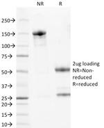 Wilm's Tumor 1 (WT1) (Wilm's Tumor and Mesothelial Marker) Antibody in SDS-PAGE (SDS-PAGE)