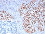 Wilm s Tumor 1 (WT1) (Wilm s Tumor and Mesothelial Marker) Antibody in Immunohistochemistry (Paraffin) (IHC (P))