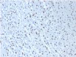 Wilm's Tumor 1 (WT1) (Wilm's Tumor and Mesothelial Marker) Antibody in Immunohistochemistry (Paraffin) (IHC (P))