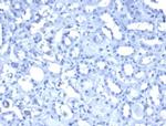 Wilms Tumor 1 (WT1) Antibody in Immunohistochemistry (Paraffin) (IHC (P))