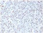 Wilm's Tumor 1 (WT1) (Wilm's Tumor and Mesothelial Marker) Antibody in Immunohistochemistry (Paraffin) (IHC (P))