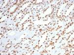 XRCC5 (Ku86/Ku80) (Thyroid-Lupus Autoantigen) Antibody in Immunohistochemistry (Paraffin) (IHC (P))