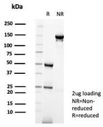 XRCC5 (Ku86/Ku80) (Thyroid-Lupus Autoantigen) Antibody in SDS-PAGE (SDS-PAGE)