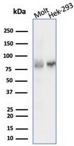 XRCC5 (Ku86/Ku80) (Thyroid-Lupus Autoantigen) Antibody in Western Blot (WB)