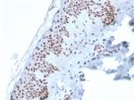 XRCC5 (Ku86/Ku80) (Thyroid-Lupus Autoantigen) Antibody in Immunohistochemistry (Paraffin) (IHC (P))