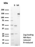 XRCC5 (Ku86/Ku80) (Thyroid-Lupus Autoantigen) Antibody in SDS-PAGE (SDS-PAGE)