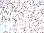 XRCC5 (Ku86/Ku80) (Thyroid-Lupus Autoantigen) Antibody in Immunohistochemistry (Paraffin) (IHC (P))