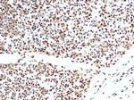 XRCC5 (Ku86/Ku80) (Thyroid-Lupus Autoantigen) Antibody in Immunohistochemistry (Paraffin) (IHC (P))