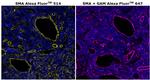 Alpha-Smooth Muscle Actin Antibody in Immunohistochemistry (Paraffin) (IHC (P))