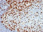 ZAP70 (Chronic Lymphocytic Leukemia Marker) Antibody in Immunohistochemistry (Paraffin) (IHC (P))