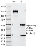 ZAP70 (Chronic Lymphocytic Leukemia Marker) Antibody in SDS-PAGE (SDS-PAGE)