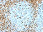 ZAP70 Antibody in Immunohistochemistry (Paraffin) (IHC (P))