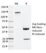 ZAP70 Antibody in SDS-PAGE (SDS-PAGE)