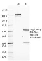 ZAP70 Antibody in SDS-PAGE (SDS-PAGE)