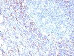 ZAP70 (Chronic Lymphocytic Leukemia Marker) Antibody in Immunohistochemistry (Paraffin) (IHC (P))