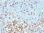 ZAP70 (Chronic Lymphocytic Leukemia Marker) Antibody in Immunohistochemistry (Paraffin) (IHC (P))