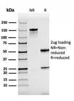 ZAP70 (Chronic Lymphocytic Leukemia Marker) Antibody in SDS-PAGE (SDS-PAGE)