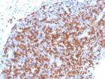 ZAP70 (Chronic Lymphocytic Leukemia Marker) Antibody in Immunohistochemistry (Paraffin) (IHC (P))