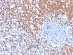 ZAP70 (Chronic Lymphocytic Leukemia Marker) Antibody in Immunohistochemistry (Paraffin) (IHC (P))