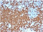 ZAP70 (Chronic Lymphocytic Leukemia Marker) Antibody in Immunohistochemistry (Paraffin) (IHC (P))