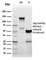 ZAP70 (Chronic Lymphocytic Leukemia Marker) Antibody in SDS-PAGE (SDS-PAGE)