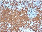 ZAP70 (Chronic Lymphocytic Leukemia Marker) Antibody in Immunohistochemistry (Paraffin) (IHC (P))