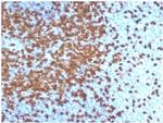 ZAP70 (Chronic Lymphocytic Leukemia Marker) Antibody in Immunohistochemistry (Paraffin) (IHC (P))