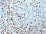 ZAP70 Antibody in Immunohistochemistry (Paraffin) (IHC (P))