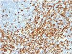 ZAP70 Antibody in Immunohistochemistry (Paraffin) (IHC (P))